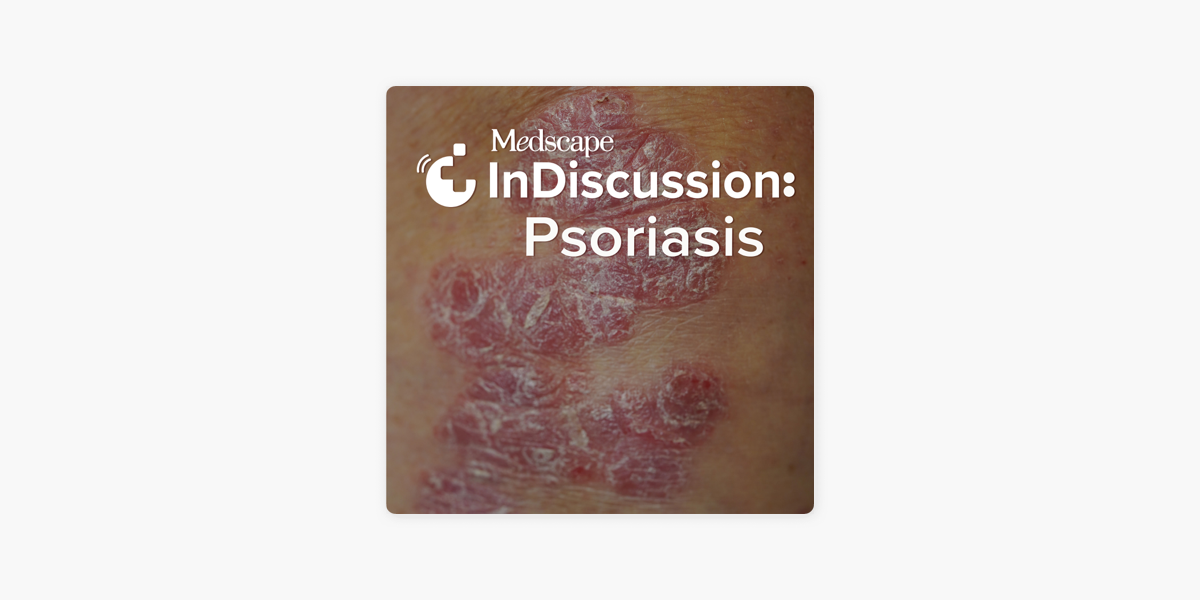 Medscape InDiscussion: Psoriasis